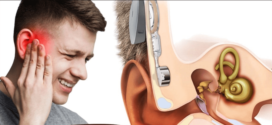 conductive hearing loss